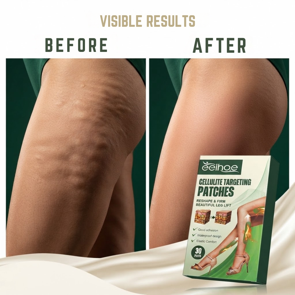 Anti-Cellulite-Pflaster | Glätten und straffen Sie Ihre Beine in nur 14 Tagen sofort sichtbar